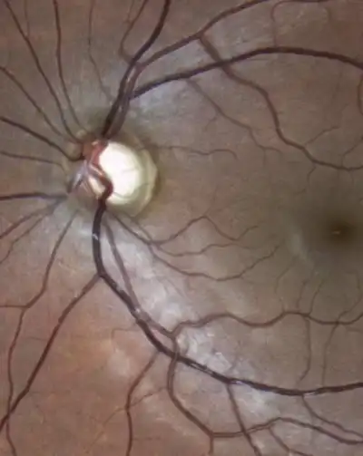 cabinet-ophtalmologie-rabat (1) (13) cabinet-ophtalmologie-rabat (1) (13)