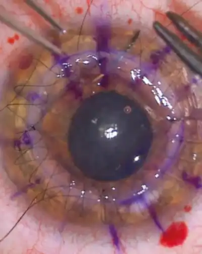 cabinet-ophtalmologie-rabat (1) (14)