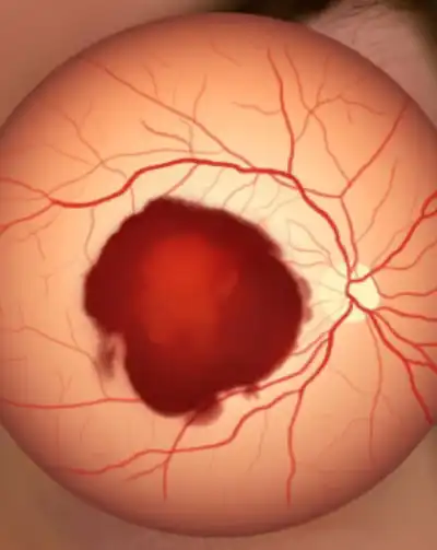 cabinet-ophtalmologie-rabat (1) (15) cabinet-ophtalmologie-rabat (1) (15)