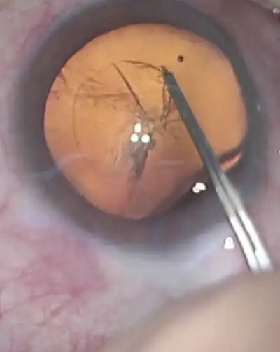 cabinet-ophtalmologie-rabat (1) (2) cabinet-ophtalmologie-rabat (1) (2)