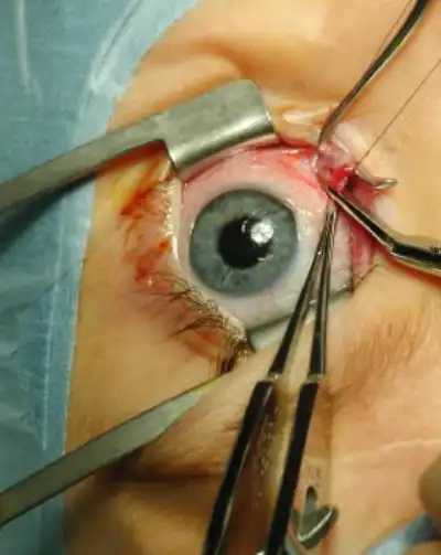 cabinet-ophtalmologie-rabat (1) (3)