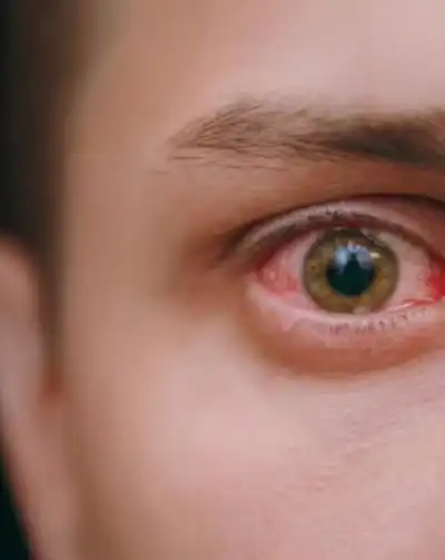 cabinet-ophtalmologie-rabat (1) (5)