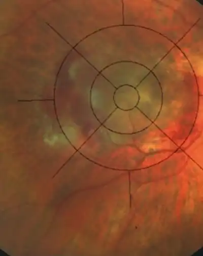 cabinet-ophtalmologie-rabat (1) (7) cabinet-ophtalmologie-rabat (1) (7)