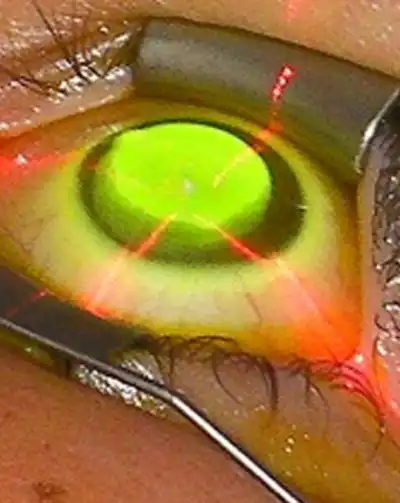 cabinet-ophtalmologie-rabat (1) cabinet-ophtalmologie-rabat (1)